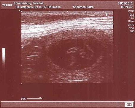 Ultraschall